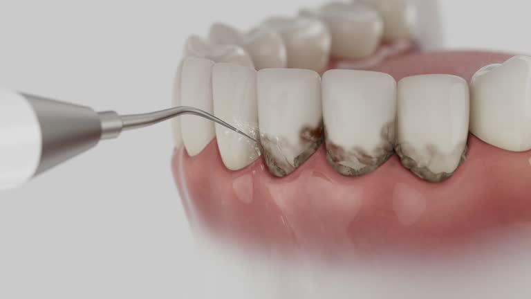 Trusted Emergency Dentist service in Campbell, MO - Dentist Open Now